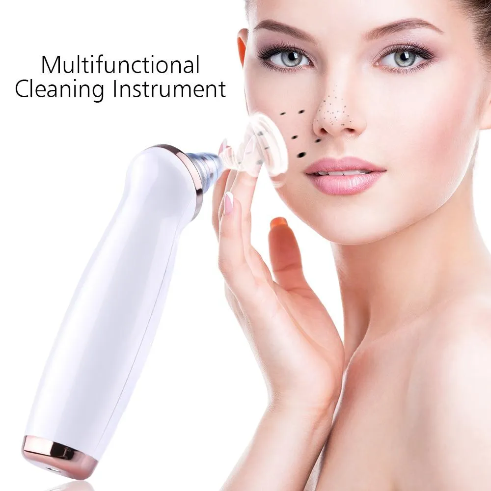 Pore Vacuum Blackhead Remover | Dermasuction